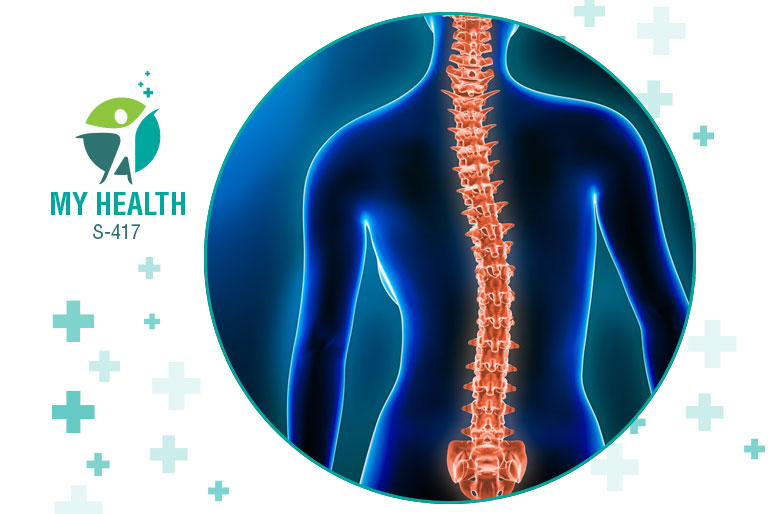 How scoliosis affects self esteem in teenage girls a closer look