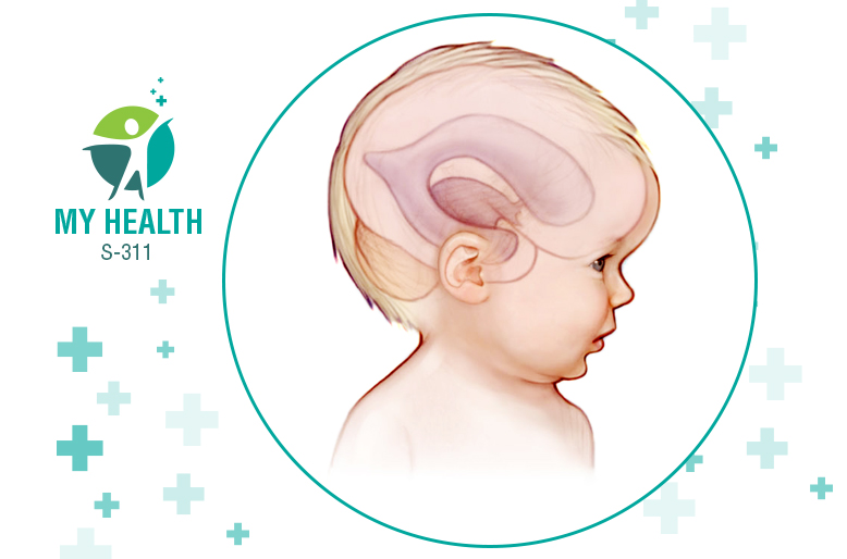 Measurement of the circumference of a 14 months old baby's head