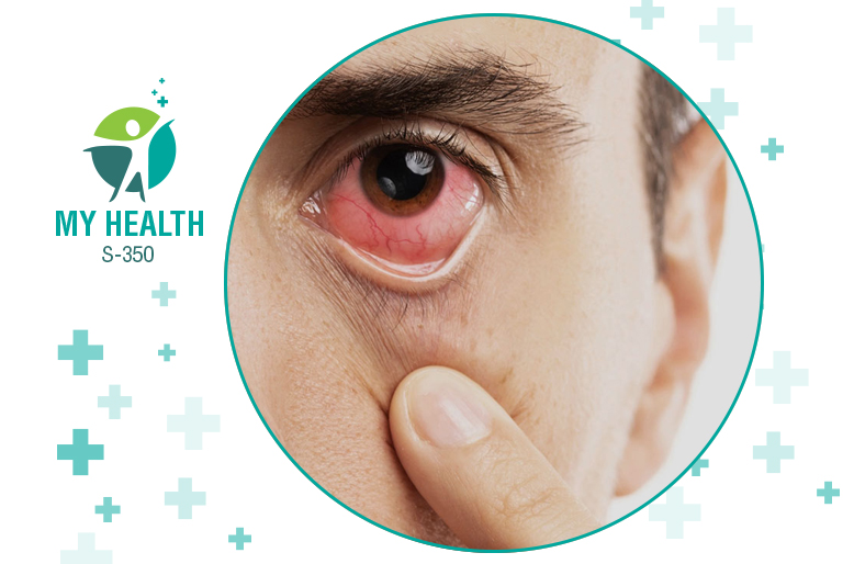 What causes mucus fishing syndrome? Symptoms, diagnosis, and treatment