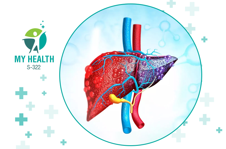 Liver Cirrhosis and Role of Ursodeoxycholic acid in its Treatment